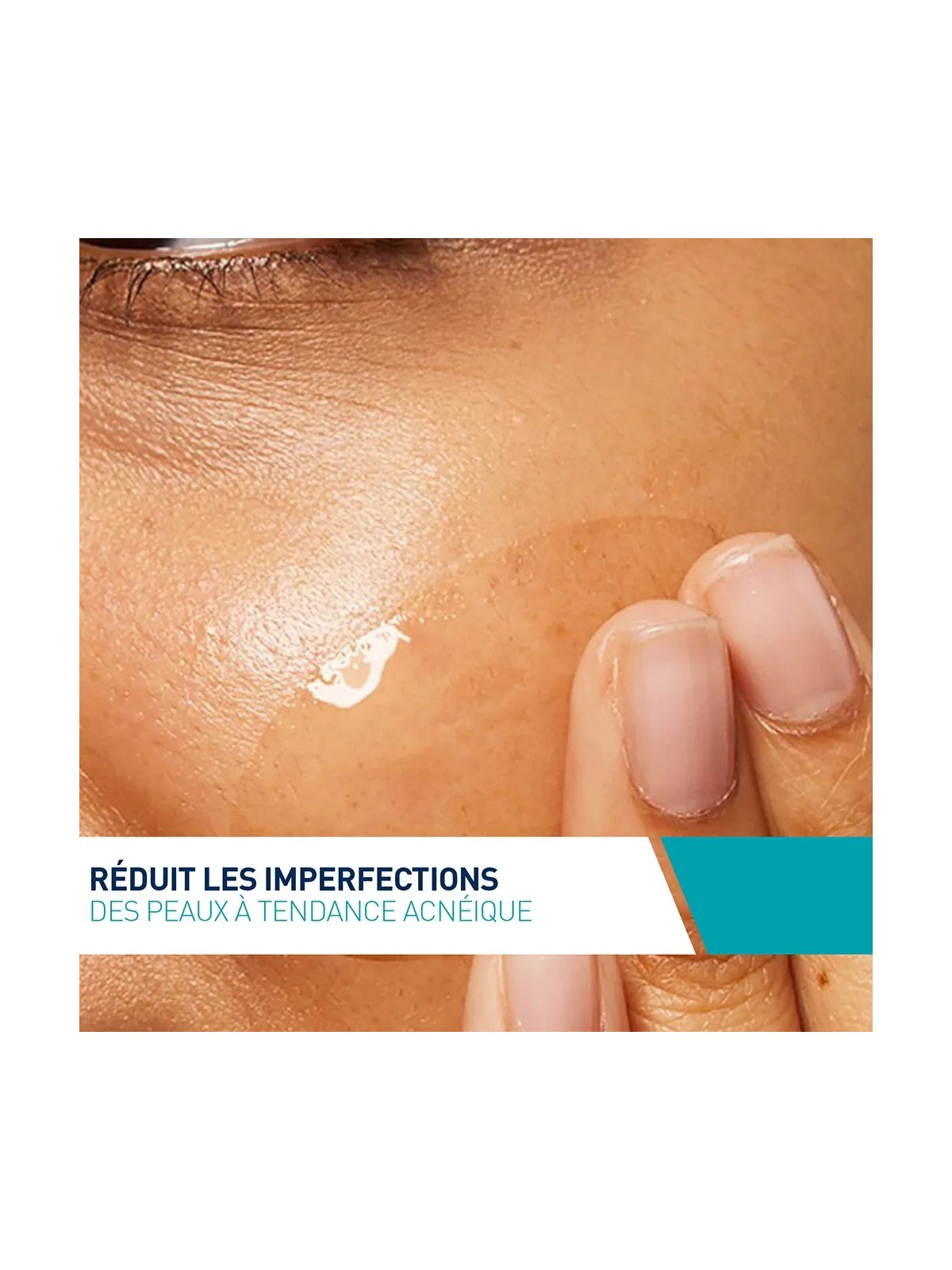 Cerave Face Soin Concentré Anti-Imperfections Peaux à imperfections et à tendance acnéique 40ml